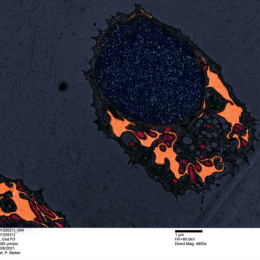 A close-up view of a cell containing a large nucleus in dark navy blue with various organelles in orange and deep magenta to the lower right. A second cells peeks up from the lower left corner. Microscopy information is below.