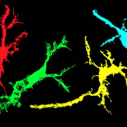 four branching neurons side by side in red, green, yellow, and cyan