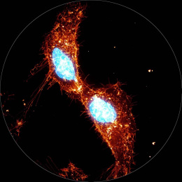 orange material stretches between and around two dividing cells with bright nuclei, appearing like eyes in a mask