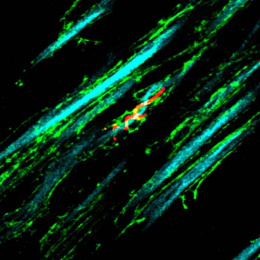 a protein spirals around a long thin bundle of axons—one of many in a field of neurons