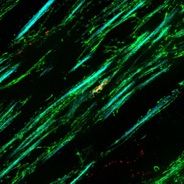 a protein spirals around a long thin bundle of axons—one of many in a field of neurons