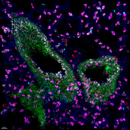 Green cell like clusters around purple cells in a black background