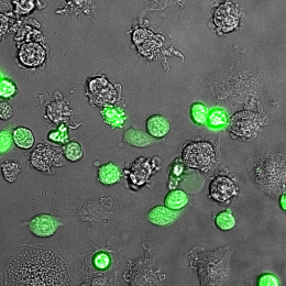 Green and grey cell like structures in a grey background